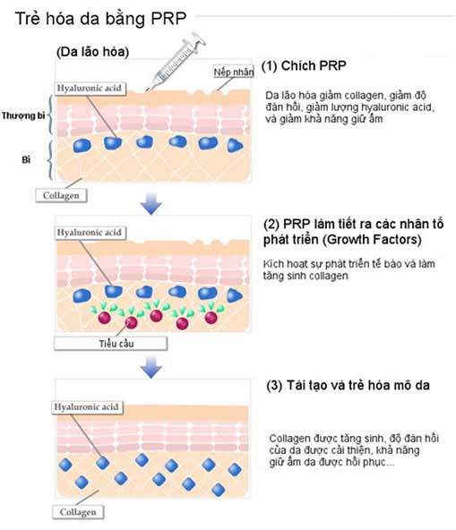 Trẻ hóa da bằng công nghệ tế bào gốc PRP